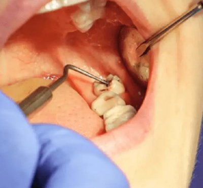Dental Examination